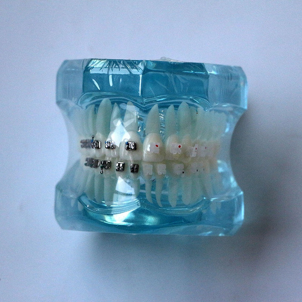Dental Orthodontic Teach Study Teeth Model Mental and Ceramic Bracket
