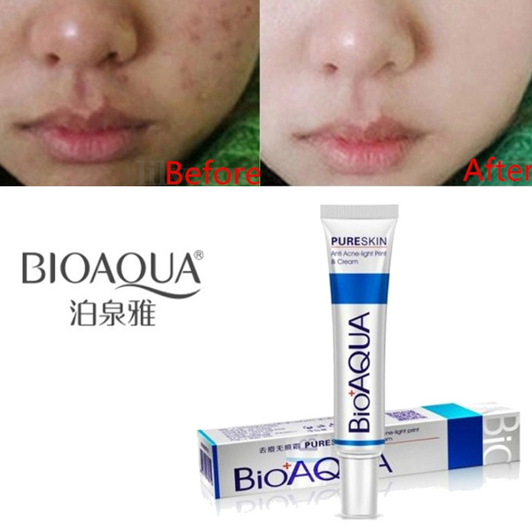 BIOAQUA Face Treatment Acne Scar Removal Cream Blemish Stretch Marks ...
