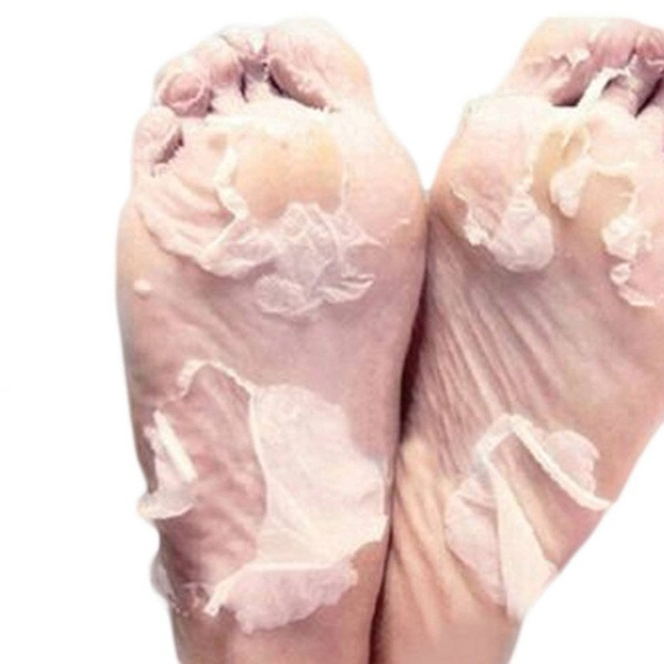 Butterfly Baby Foot Peeling Renewal Mask Remove Dead Skin Cuticles Heel