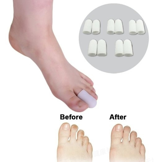 2 Pcs Toe Protector For Foot Corns Remover and Reduce Blisters & Callus ...