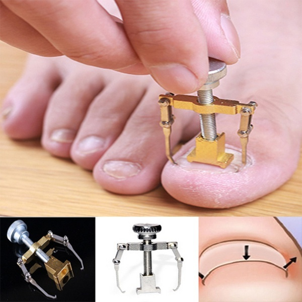 toe protectors ingrown toenail