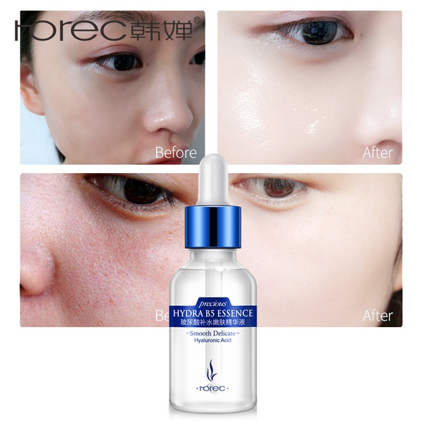 serum facial anti acne