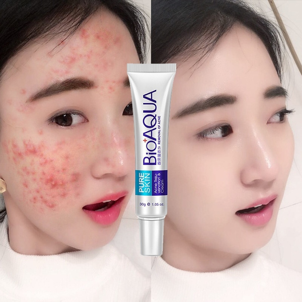 best skin care acne scars