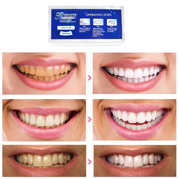 luxe crest whitening strips