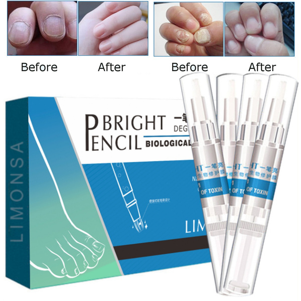 4pcs Bright Pencil Nail Fungal Treatment Anti Fungus Biological Repair Solution Wish