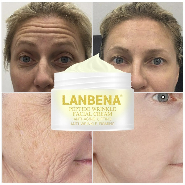 forehead tightening cream