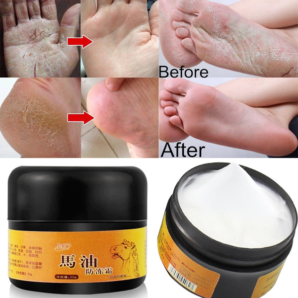 feet cream