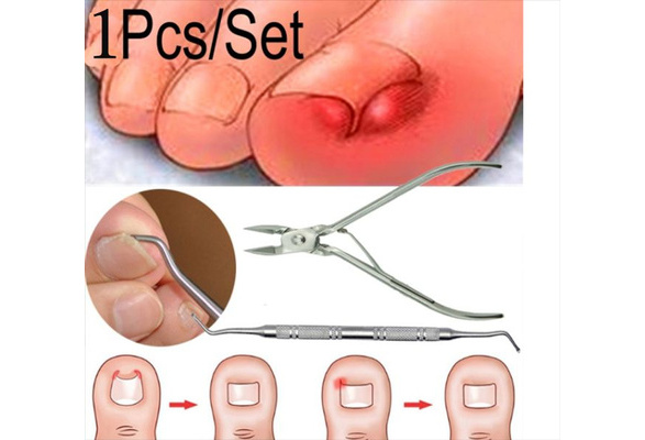Ingrown Toe Nail Correction Nippers Clipper Cutters Dead Skin Dirt Remover Paronychia Podiatry Pedicure Care Tool Stainless Steel Cuticle Cutter Scissor Dead Skin Remover Clipper Nipper Trimmer Manicure Nail Beauty Tools