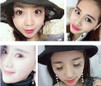 thumbnail - 3
