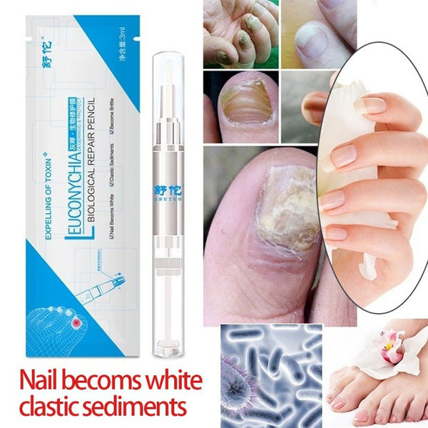 Nail Fungal Treatment Cream Anti Infection Cures Onychomycosis Toes Hand  Cracking Thickening Yellowing Paronychia Care Ointment - AliExpress