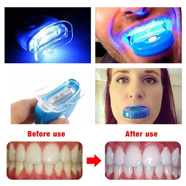 New Fashion Home Smile Teeth Whitening Kit Gel Bright White Dental Diagnostic Tool Oral Bleaching Led White Light Oral Gel Kit One Beauty Tooth Meter No Whitening Gel Wish