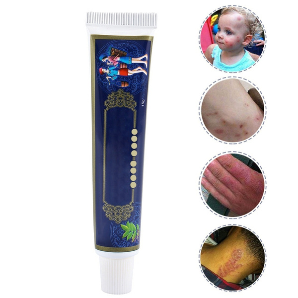 Body Cream Ointment Dermatitis and Eczema Pruritus Creams for All Skin Problems Anti