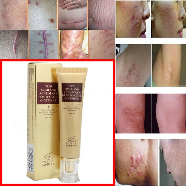 off mark face cream