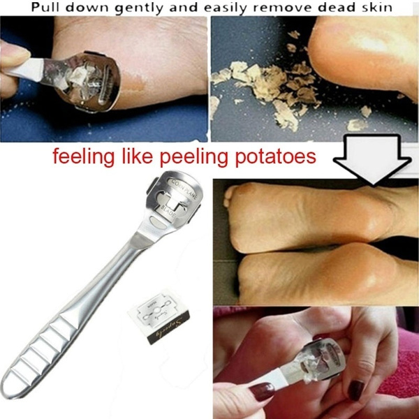 Best Way to Remove Dead Skin From Your Feet