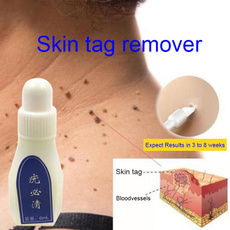 6ml/Bottle ST Wart Remover Body Skin Care External Use