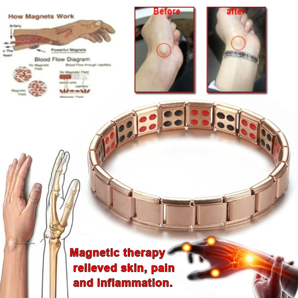 magnetic wristbands for arthritis