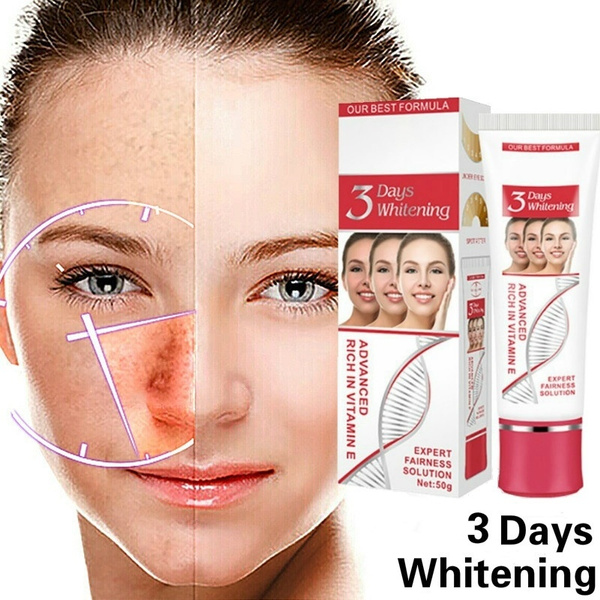 hulp Encyclopedie muis of rat Donkere plek Corrector Huid Whitening Vervagen Crème Vlekverwijdering Vermindert ouderdomsvlekken Sproeten Melasma Gezichtscrème | Wish hulp Encyclopedie muis of rat Donkere plek Corrector Huid Whitening Vervagen Crème Vlekverwijdering Vermindert ouderdomsvlekken Sproeten Melasma Gezichtscrème | Wish