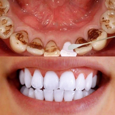 Magic Natural Teeth Whitening Tooth Brushing Physical Teeth Whitener Detoxifying Whitening Oralh Dental Oral Hygiene
