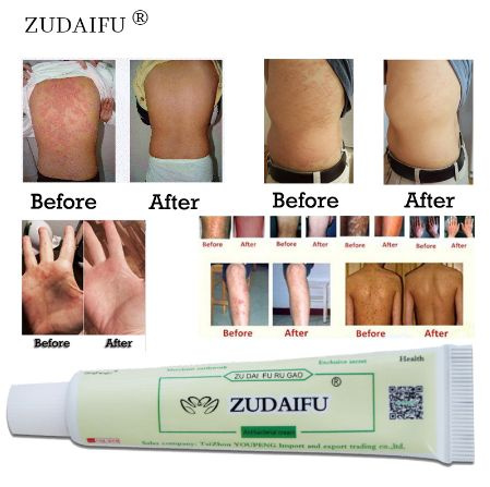 1 Piece Zudaifu Sulfur Sulphur Soap Skin Repair Clearance Acne