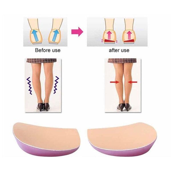 insoles for bow legs