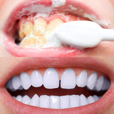 teethwhitenning, teethstainremover, Whitening, dental