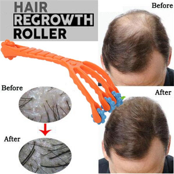 1 Pc Color Random Hair Regrowth Roller Four Claw Type Head Massager Roller Foot Hand Body Neck Massage Tool