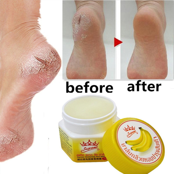 Anti Fungal Foot Repair Foot Cream Dead Skin Removal Peeling