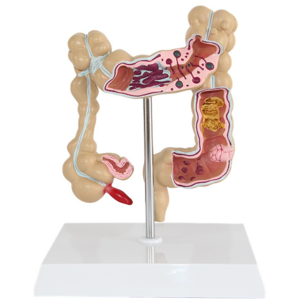 Human Large Intestine Colon Anatomy Model | Wish