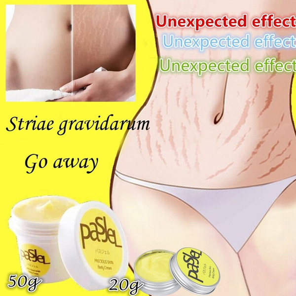 striae treatment cream