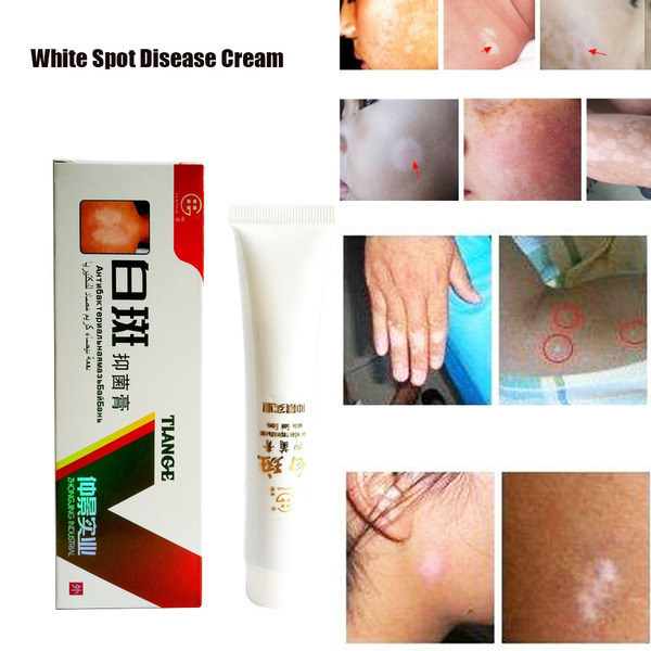 white spot cream