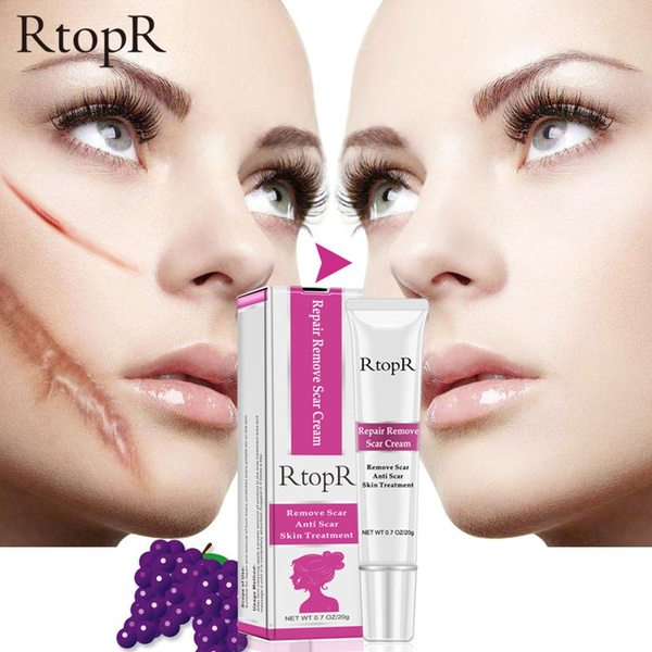 rtopr stretch mark cream