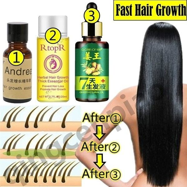 Say goodbye to hair loss! Chinese herbal fast hair growth essential oil  （recommend 1+2+3） | Wish