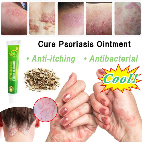 Professional cure psoriasis ointment medicine ingredient security for