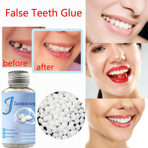 Temporary missing dental prosthetic kit 