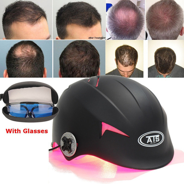 New 128 Diodes Laser Cap LLLT Hair Regrowth Therapy Hair Loss Treatment  Helmet | Wish