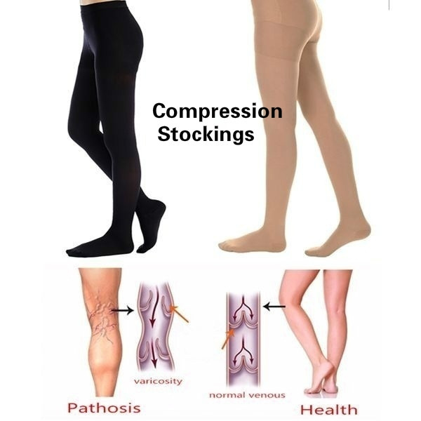 Varicose Vein Open Loe Health Wellness 