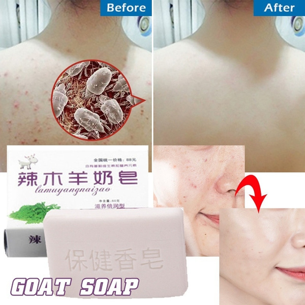 bleaching soap before and after