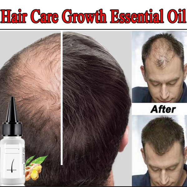 20 Ml Hair Care Growth Essential Oil Essence Hair Loss Health Care Beauty Thick  Hair Growth Essence | Wish