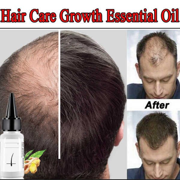 20 Ml Hair Care Growth Essential Oil Essence Hair Loss Health Care Beauty Thick Hair Growth Essence | Wish 20 Ml Hair Care Growth Essential Oil Essence Hair Loss Health Care Beauty Thick Hair Growth Essence | Wish