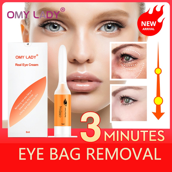 instant dark circle removal cream