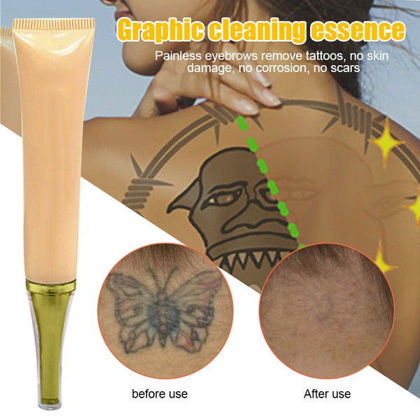 Jaysuing Tattoo Removal Cream Permanent Tattoo Removal Cream Painless –  EELHOE