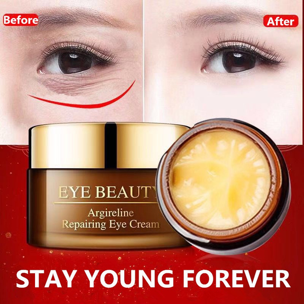 best cream to remove dark circles