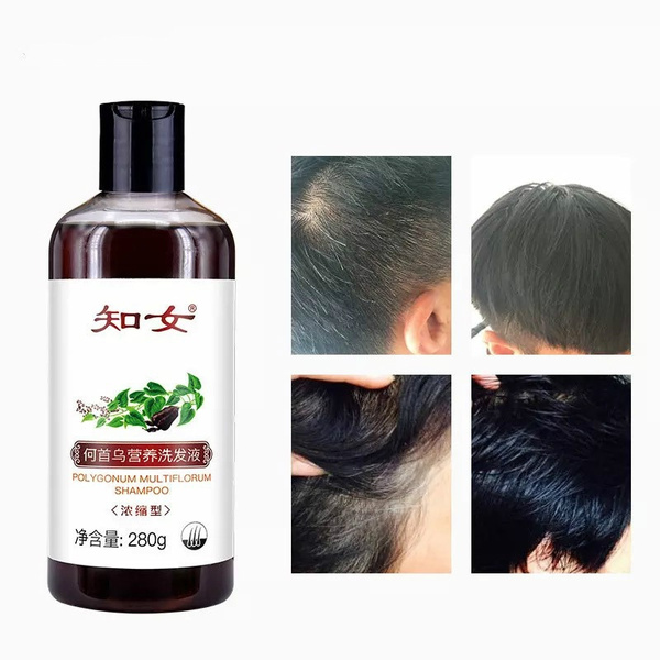Grey Hair Removal Anti White Hair Shampoo Treatment Of Black