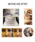 thumbnail - 2