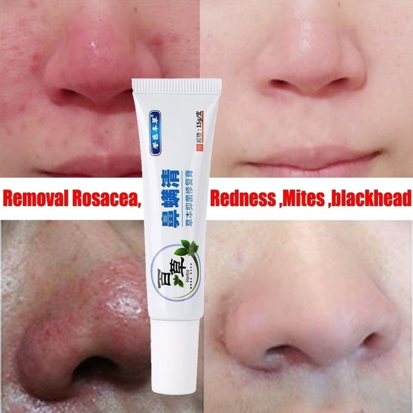 rosacea gel cream