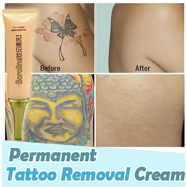 NonLaser Tattoo Removal  Ink  Body Shop