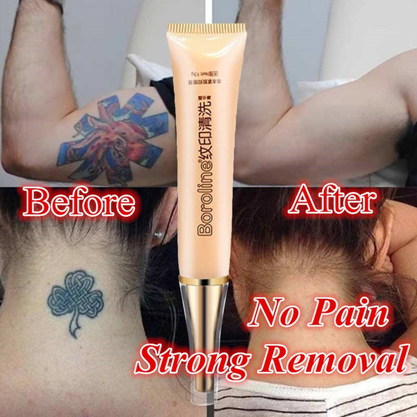 NO Need For Pain!!!100%Natural Formula Permanent Tattoo Removal Cream Fast  Maximum Strength Dark Spot Tattoo Removal | Wish