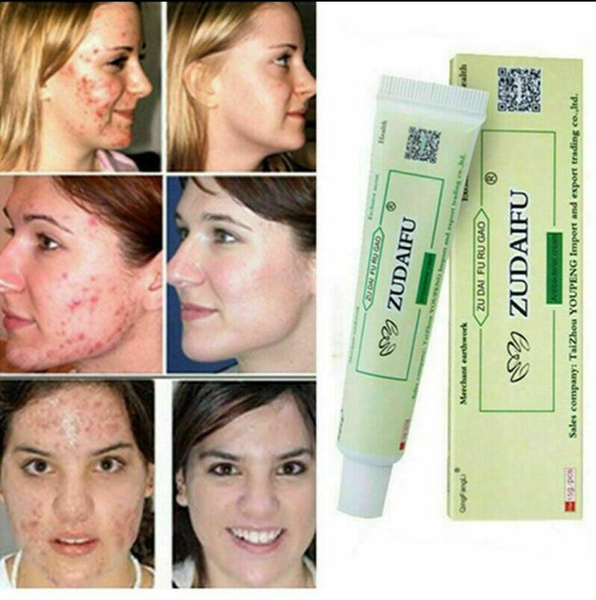antibacterial cream for acne