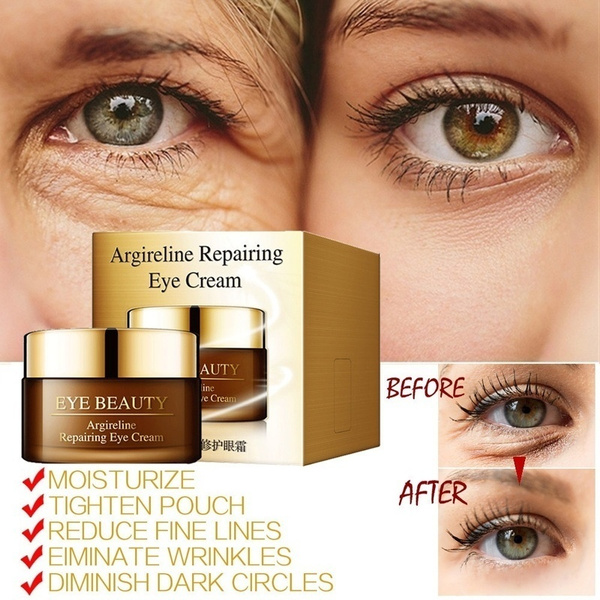 best cream for eye bags