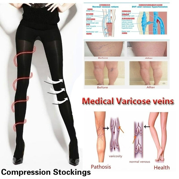 Vein tights clearance